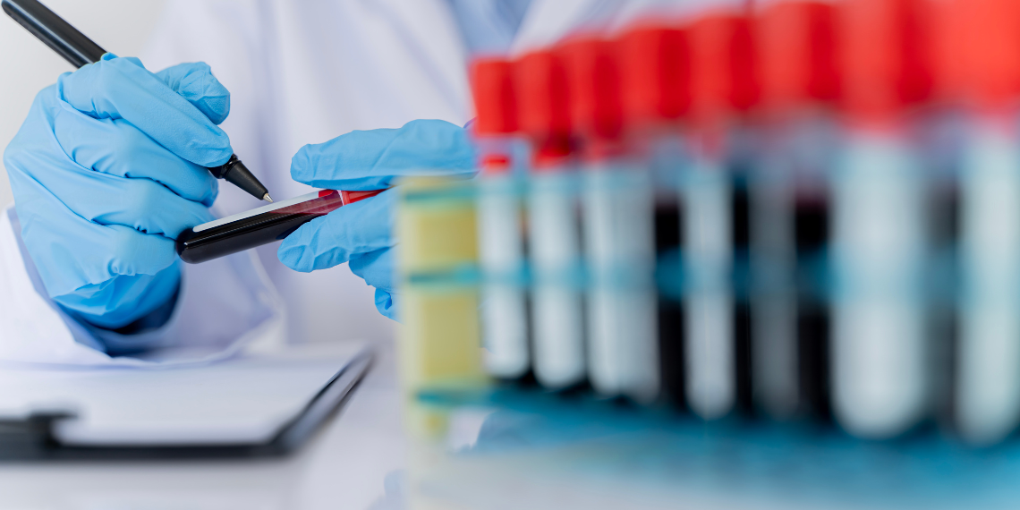 A laboratory technician in blue gloves labels a blood sample vial, with a rack of test tubes in the foreground and a clipboard in the background.